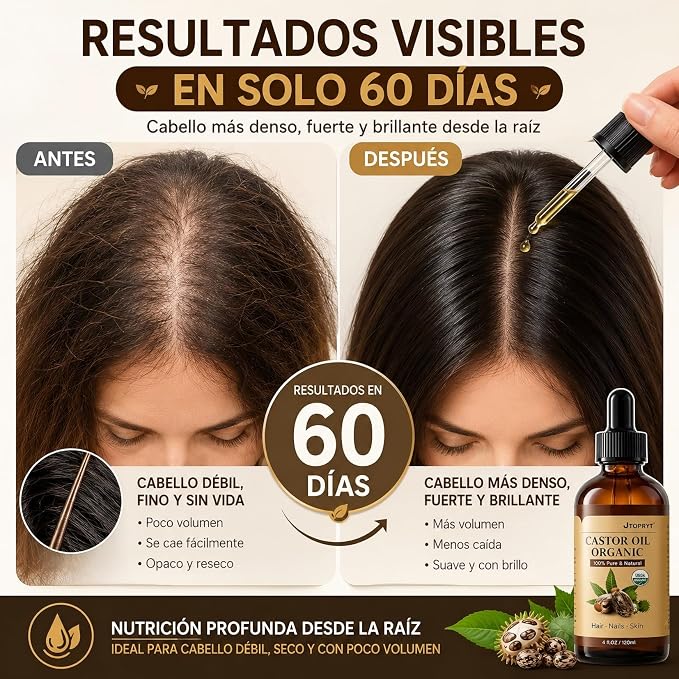 ACEITE DE CASTOR OIL ORGÁNICO PREMIUM – 100% PURO, PRENSADO EN FRÍO