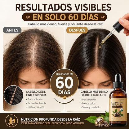 ACEITE DE CASTOR OIL ORGÁNICO PREMIUM – 100% PURO, PRENSADO EN FRÍO